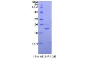 SDS-PAGE (SDS) image for Sialic Acid Binding Ig-Like Lectin 12 (SIGLEC12) (AA 317-512) protein (His tag) (ABIN2122082)