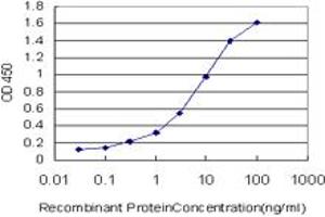Detection limit for recombinant GST tagged CRX is approximately 0. (CRX antibody  (AA 1-95))