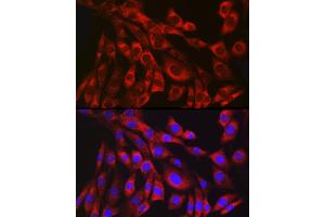 Immunofluorescence analysis of NIH/3T3 cells using Collagen III alpha 1/COL3 antibody (ABIN7266459) at dilution of 1:100. (COL3 antibody)