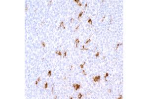 Immunohistochemistry (IHC) image for anti-CD68 Molecule (CD68) antibody (ABIN7449045) (Recombinant CD68 antibody)