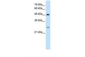 Image no. 1 for anti-SH3 Domain Binding Glutamic Acid-Rich Protein (SH3BGR) (AA 139-188) antibody (ABIN6738186) (SH3BGR antibody  (AA 139-188))