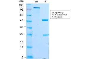 SDS-PAGE Analysis Purified MITF Recombinant Rabbit Monoclonal Antibody (MITF/2987R).