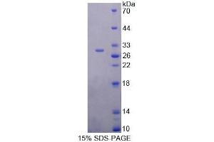SDS-PAGE analysis of Human EIF4H Protein.