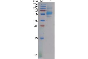 Human CA Protein, hFc Tag on SDS-PAGE under reducing condition.