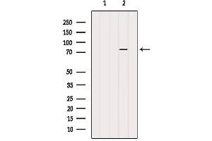 PARP2 antibody  (Internal Region)