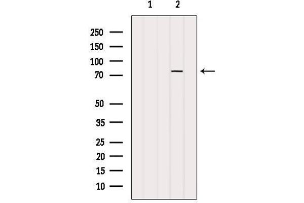 PARP2 antibody  (Internal Region)