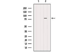 Western blot analysis of extracts from 3T3, using PARP2 Antibody.
