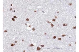 ABIN6268809 at 1/100 staining human brain tissue sections by IHC-P. (HNRNPC antibody  (C-Term))