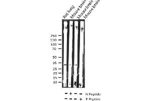 Western blot analysis of Phospho-C/EBP beta (Thr235/188) expression in various lysates (CEBPB antibody  (pThr235))
