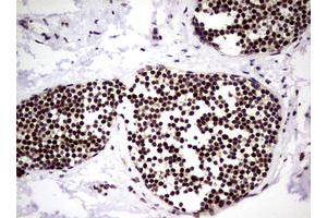 Image no. 1 for anti-Nibrin (NBN) (AA 183-460) antibody (ABIN1491058) (Nibrin antibody  (AA 183-460))