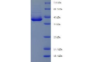 SDS-PAGE (SDS) image for Apoptosis Enhancing Nuclease (AEN) (AA 117-325), (partial) protein (His-SUMO Tag) (ABIN4976576) (AEN Protein (AA 117-325, partial) (His-SUMO Tag))