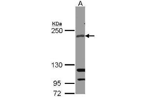 WB Image Sample(30 ug whole cell lysate) A: A431 , 5% SDS PAGE antibody diluted at 1:1000 (RICTOR antibody  (C-Term))