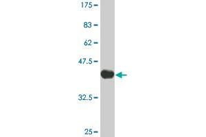 Western Blot detection against Immunogen (36. (IRAK2 antibody  (AA 111-210))