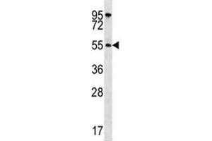 AKT1 antibody western blot analysis in HeLa lysate (AKT1 antibody  (AA 115-144))