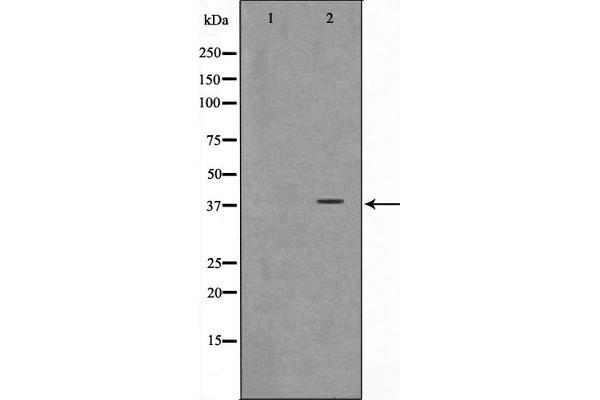 ARMCX3 antibody  (N-Term)