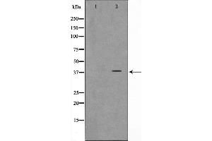Western blot analysis on K562 cell lysate using ARMX3 Antibody,The lane on the left is treated with the antigen-specific peptide. (ARMCX3 antibody  (N-Term))