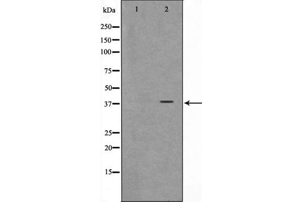 ARMCX3 antibody  (N-Term)