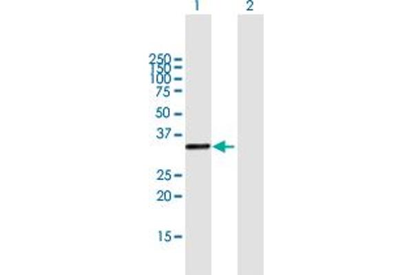 UVSSA/KIAA1530 antibody  (AA 1-260)