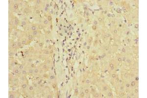 Immunohistochemistry of paraffin-embedded human liver tissue using ABIN7163092 at dilution of 1:100 (PDCL2 antibody  (AA 1-241))
