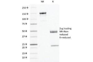 SDS-PAGE Analysis of Purified, BSA-Free IFN gamma Antibody (clone IFNG/466). (Interferon gamma antibody)