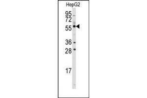 Image no. 1 for anti-Aldehyde Dehydrogenase 3 Family, Member B1 (ALDH3B1) (C-Term) antibody (ABIN360239) (ALDH3B1 antibody  (C-Term))