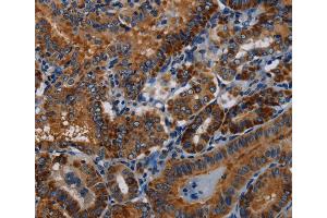 Immunohistochemistry (IHC) image for anti-P53-Induced Death Domain Protein (PIDD) antibody (ABIN5544547)