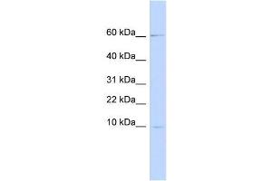 Image no. 1 for anti-Peptidase Inhibitor 3, Skin-Derived (PI3) antibody (ABIN635954) (PI3 antibody)