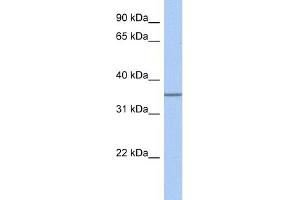 WB Suggested Anti-GLT6D1 Antibody Titration:  0. (GLT6D1 antibody  (Middle Region))