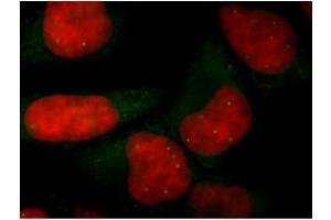 Image no. 1 for anti-Survival of Motor Neuron 1, Telomeric (SMN1) antibody (ABIN2628560) (SMN1 antibody)