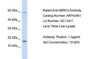 WB Suggested Anti-HERC4 Antibody   Titration: 1. (HERC4 antibody  (Middle Region))