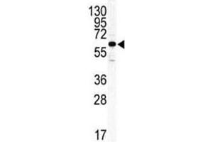 Western blot analysis of ILK2/ILK1 antibody and HeLa lysate. (ILK antibody  (AA 391-421))
