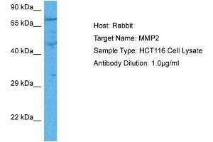 Host:  Rabbit  Target Name:  MMP2  Sample Tissue:  Human HCT116 Whole Cell  Antibody Dilution:  1ug/ml (MMP2 antibody  (C-Term))