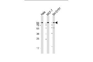 All lanes : Anti-DAG1 Antibody (C-term) at 1:2000 dilution Lane 1: Hela whole cell lysate Lane 2: MCF-7 whole cell lysate Lane 3: SH-SY5Y whole cell lysate Lysates/proteins at 20 μg per lane.