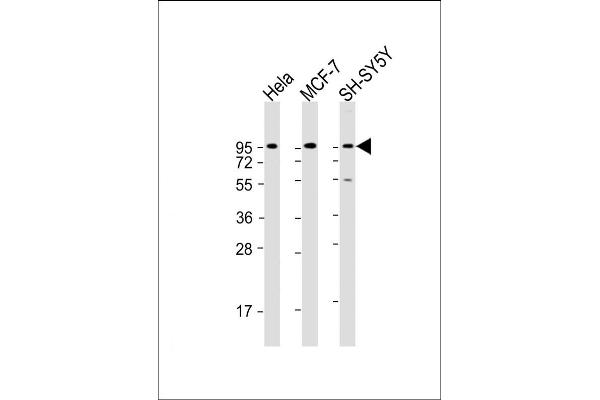 Dystroglycan anticorps  (C-Term)