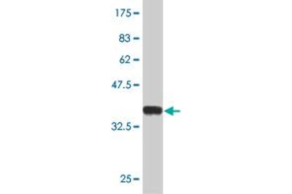 MECP2 antibody  (AA 81-170)