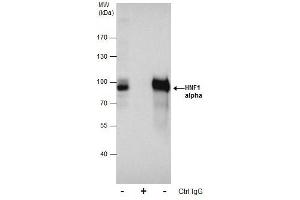 IP Image Immunoprecipitation of HNF1 alpha protein from HepG2 whole cell extracts using 5 μg of HNF1 alpha antibody [N1N3], Western blot analysis was performed using HNF1 alpha antibody [N1N3], EasyBlot anti-Rabbit IgG  was used as a secondary reagent. (HNF1A antibody)