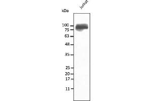 Western Blotting (WB) image for anti-Integrin beta 2 (ITGB2) (N-Term) antibody (ABIN7273029) (Integrin beta 2 antibody  (N-Term))