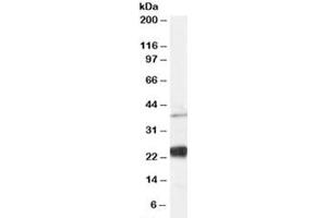 Western blot testing of human HeLa cell lysate and NIP antibody at 0.