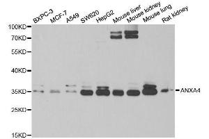 Western blot analysis of extracts of various cell lines, using ANXA4 antibody.