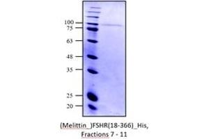 SDS-PAGE (SDS) image for Follicle Stimulating Hormone Receptor (FSHR) (AA 18-366) protein (His tag) (ABIN3080496)