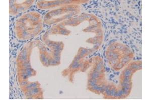 IHC-P analysis of Mouse Ovary Tissue, with DAB staining. (PDGFRB antibody  (AA 337-583))