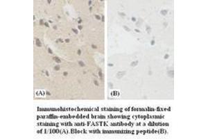 Image no. 1 for anti-Fas-Activated serine/threonine Kinase (FASTK) antibody (ABIN791134)