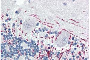 Human Brain, Cerebellum (formalin-fixed, paraffin-embedded) stained with MBP antibody ABIN364503 at 1:100 followed by biotinylated goat anti-rabbit IgG secondary antibody ABIN481713, alkaline phosphatase-streptavidin and chromogen. (MBP antibody)