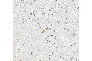 anti-Ribosomal Protein L29 (RPL29) (AA 27-153) antibody