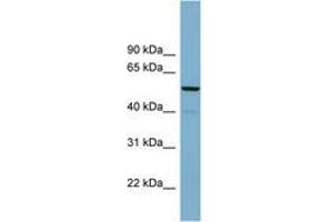 Image no. 1 for anti-CDK5 Regulatory Subunit Associated Protein 1 (CDK5RAP1) (AA 92-141) antibody (ABIN6742000) (CDK5RAP1 antibody  (AA 92-141))