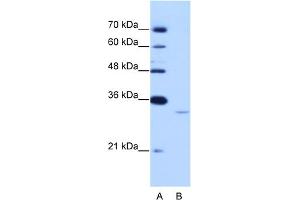 WB Suggested Anti-EXOSC6 Antibody Titration:  0. (EXOSC6 antibody  (N-Term))