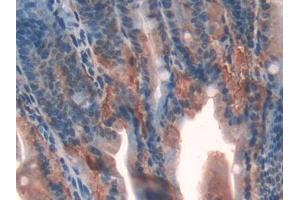 Used in DAB staining on fromalin fixed paraffin- embedded spleen tissue (Galectin 9 antibody  (AA 194-322))
