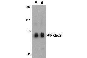 Image no. 1 for anti-Mex-3 Homolog C (C. Elegans) (MEX3C) (C-Term) antibody (ABIN341683) (MEX3C antibody  (C-Term))