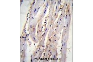STX19 Antibody (C-term) (ABIN655437 and ABIN2844972) immunohistochemistry analysis in formalin fixed and paraffin embedded m. (Syntaxin 19 antibody  (C-Term))