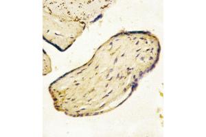 Formalin-fixed and paraffin-embedded human Placenta tissue reacted with CD73 (NT5E) Antibody (C-term), which was peroxidase-conjugated to the secondary antibody, followed by AEC staining. (CD73 antibody  (C-Term))